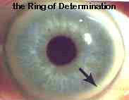 The Ring of Determination