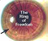 The Ring of Freedom